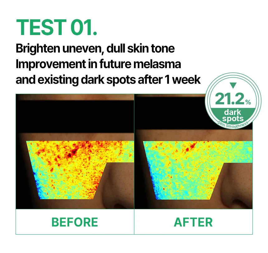 DAMTONE Dark Spot Care Toning Cream — 詳細画像11